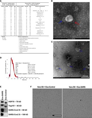 Proteomic profiling of single extracellular vesicles reveals colocalization of SARS-CoV-2 with a CD81/integrin-rich EV subpopulation in sputum from COVID-19 severe patients